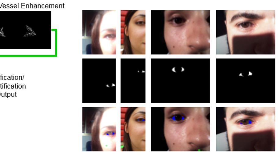 ScleraSegNet: An Attention Assisted U-Net Model for Accurate Sclera Segmentation